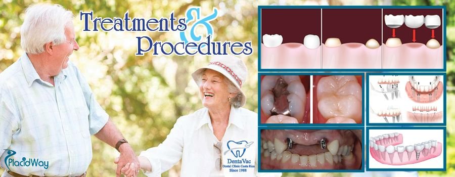 Dental Procedures offered by Dentavac Dental Clinic in San Jose Costa Rica